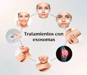 Tratamiento con exosomas