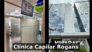 Clínica capilar Bogotá