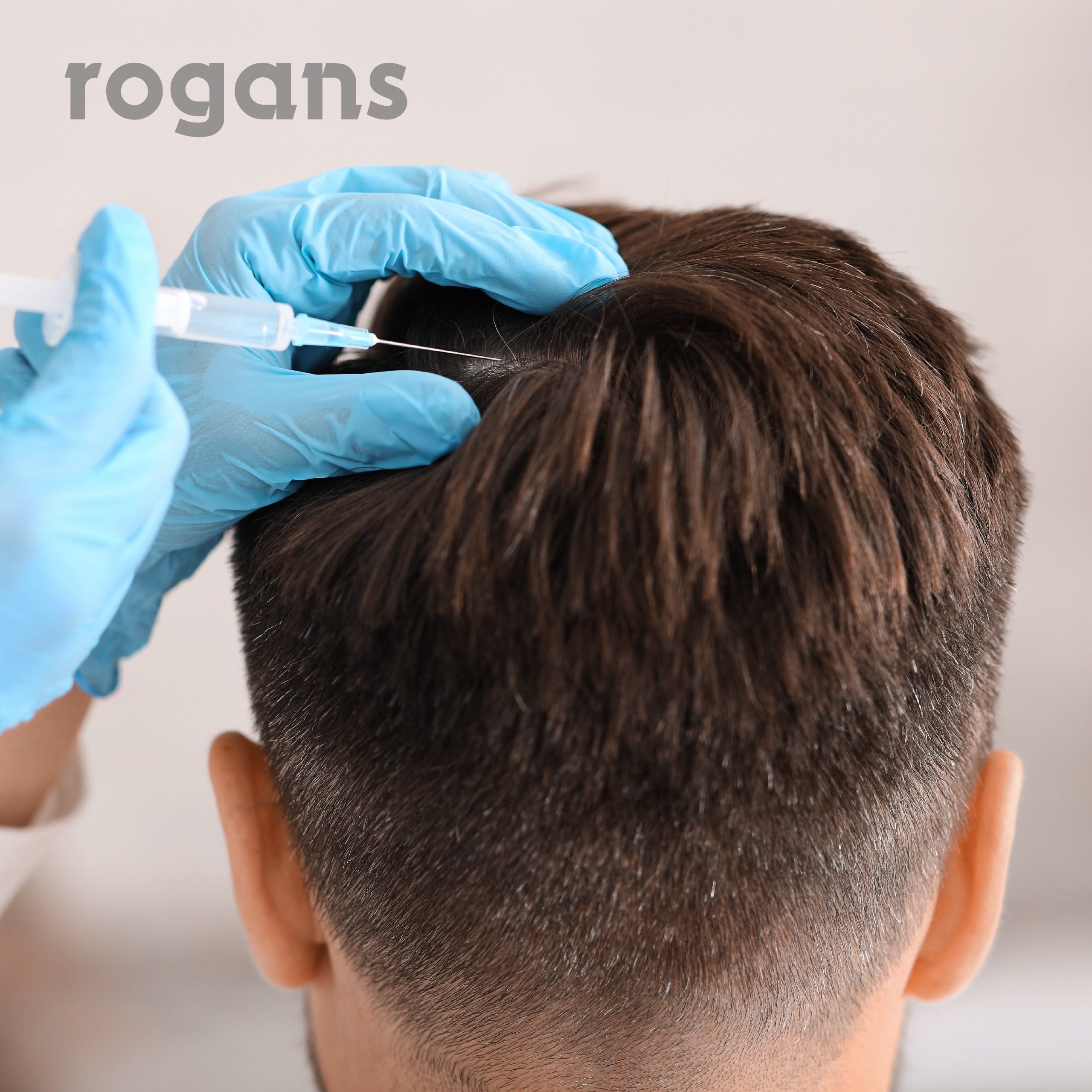 post | Tratamiento Capilar: Mas de 5 alternativas para la caida del cabello