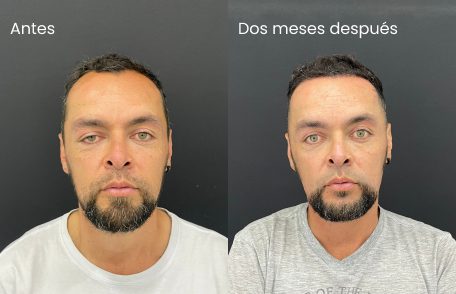 Testimonio de Alexander en especialidad Restauración capilar