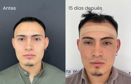 Testimonio de Andrés en especialidad Restauración capilar