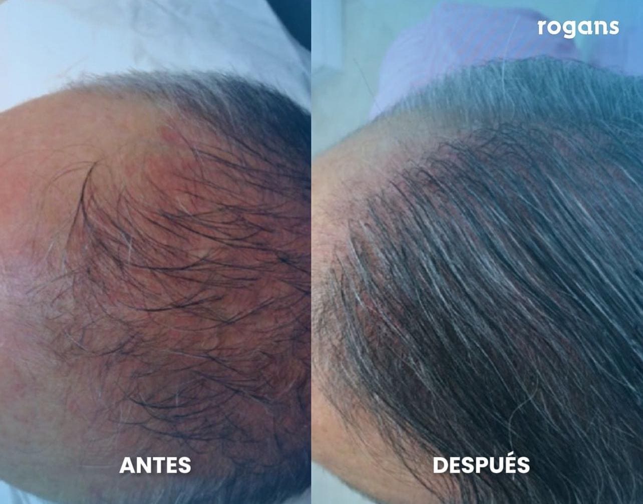 Testimonio de Anónimo en especialidad Restauración capilar