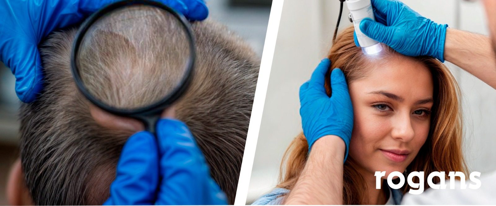 post | Enfermedades del Cabello: Causas,  6 Tratamientos y Cuidados Esenciales para un Cabello Saludable