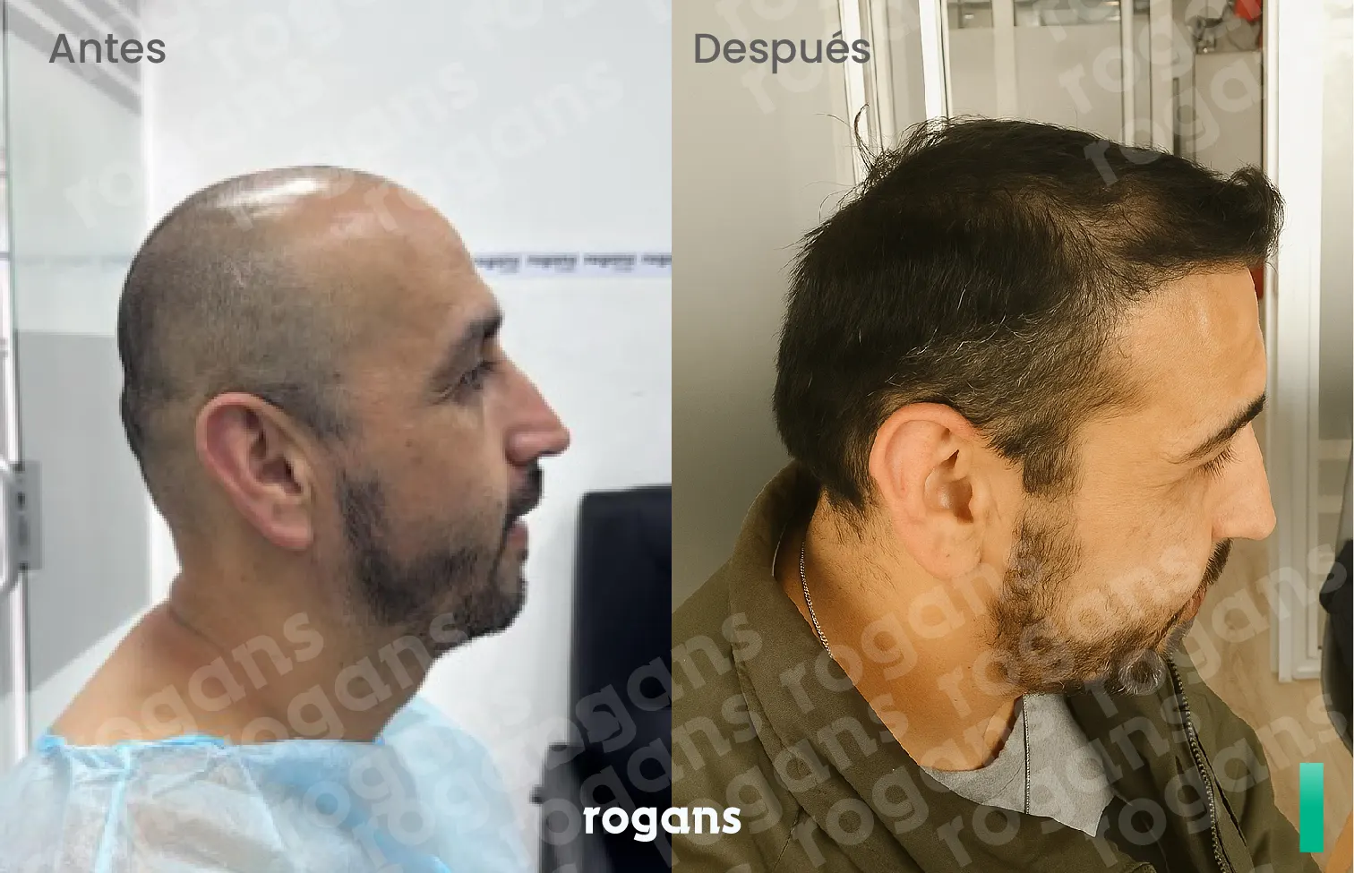 Testimonio de Anónimo en especialidad Restauración capilar